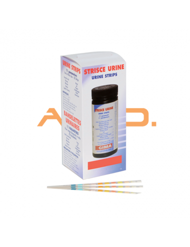 Urine biochemical examination