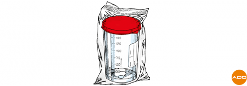 Sterile Behälter - 150 ml