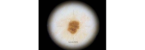 Adapter Dermlite for small areas DL4