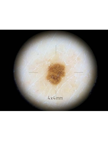 Adapter difficult areas...