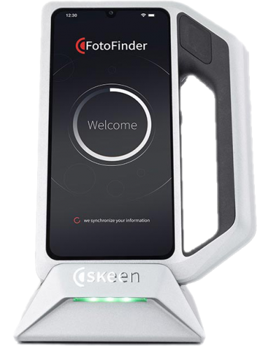 Skeen - Dermatoscope...