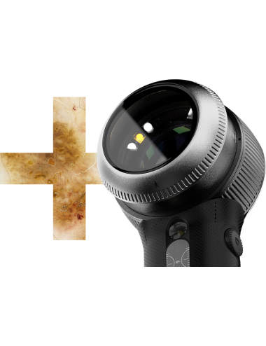 Dermatoscope DermLite DL5 Plus