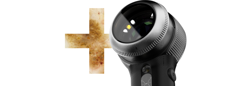 Dermatoscope DermLite DL5 Plus