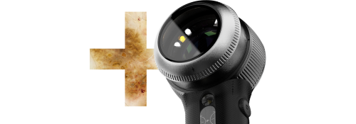 Dermatoscope DermLite DL5 Plus