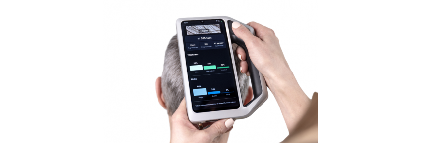 AIMEE l'intelligence artificielle pour les cheveux de FotoFinder Skeen