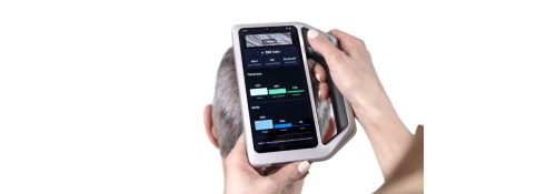 AIMEE l'intelligence artificielle pour les cheveux de FotoFinder Skeen