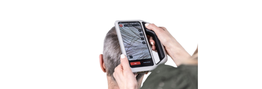 FotoFinder Skeen - Diagnostic numérique pour la trichologie et la dermatoscopie avec Intelligence Artificielle