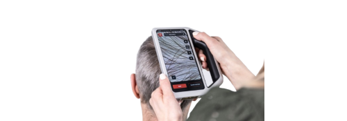 FotoFinder Skeen - Digital diagnosis for trichology and dermatoscopy with Artificial Intelligence