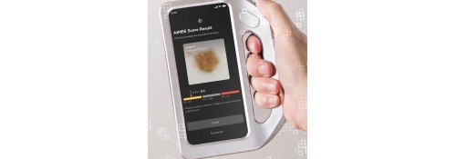 DermLite skeen by FotoFinder with FotoFinder AI score on 6.7" touchscreen