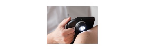 Lente per dermoscopia di DermLite skeen con illuminazione LED