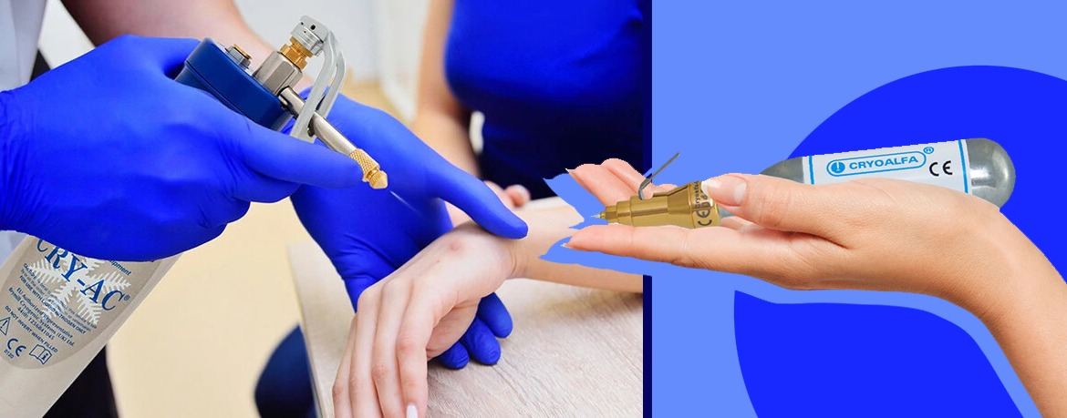 Soluzioni Criogeniche per la Medicina: Confronto tra Brymill Cryogenic Systems e Cryoalfa Super