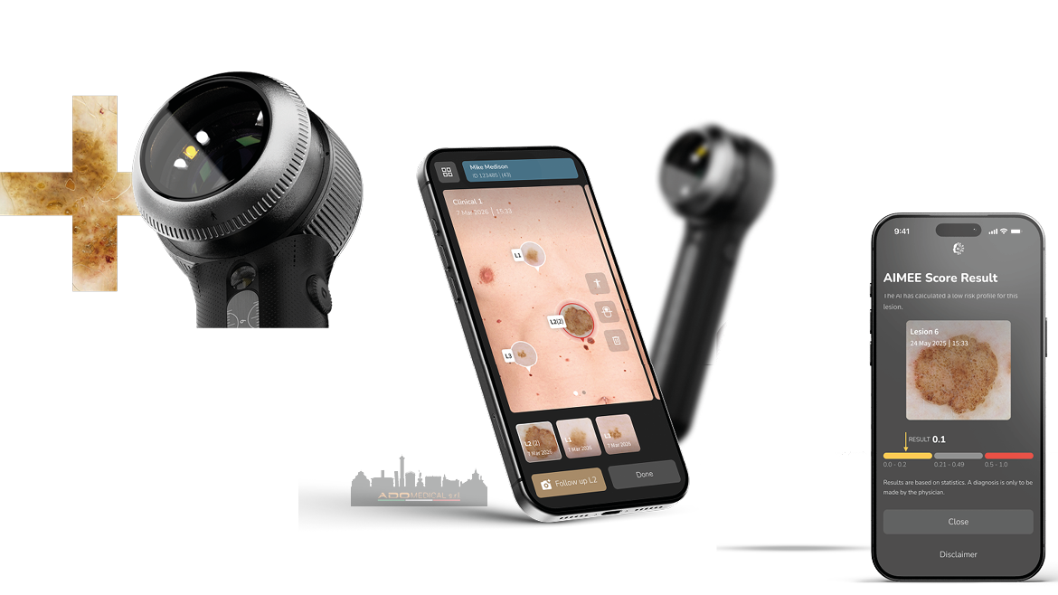 DermLite DL5 Plus: Il nuovo dermatoscopio professionale con App e luce UV potenziata